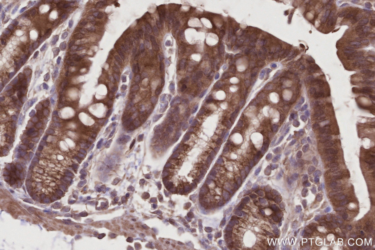 Immunohistochemical analysis of paraffin-embedded mouse colon tissue slide using KHC2776 (SLC25A46 IHC Kit).