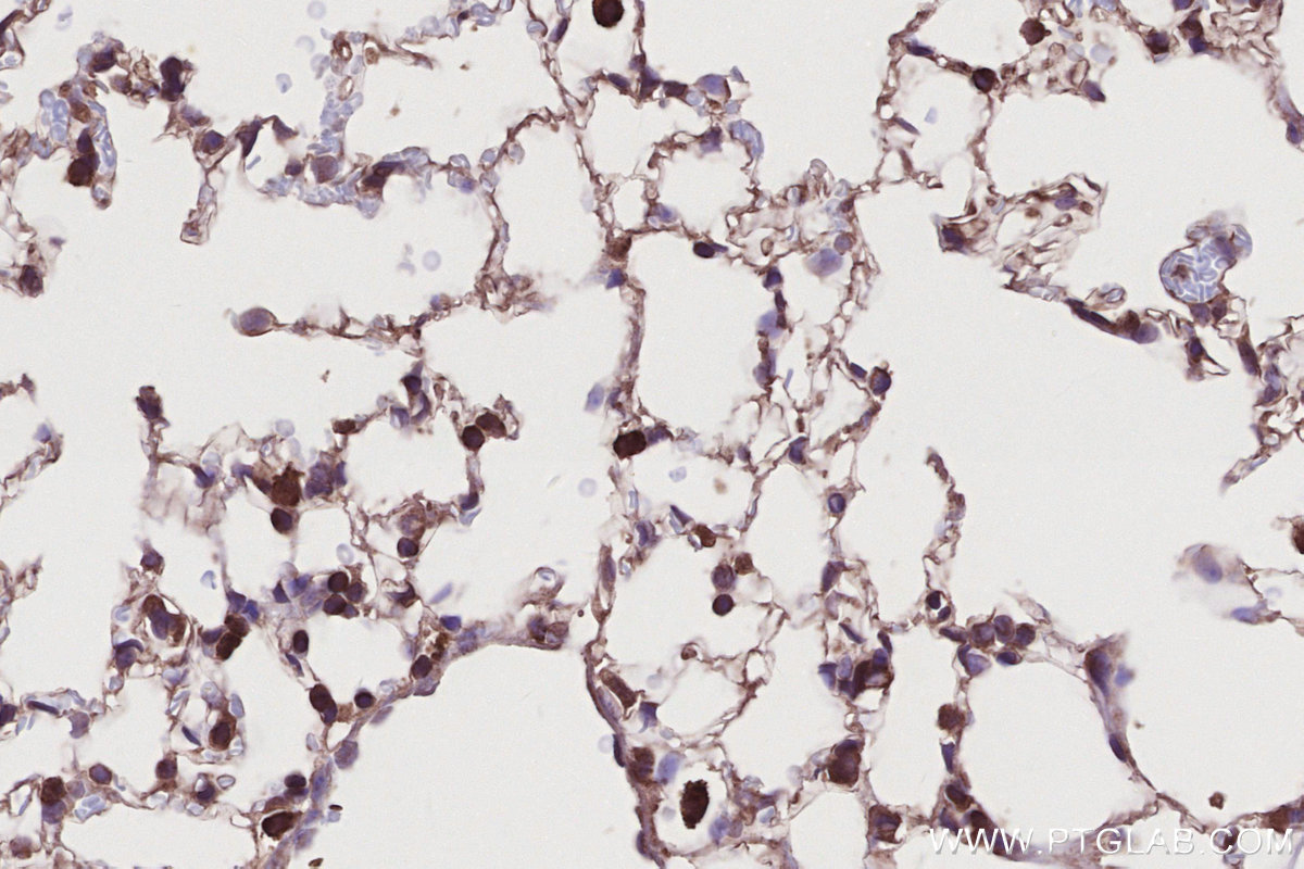 Immunohistochemical analysis of paraffin-embedded mouse lung tissue slide using KHC2776 (SLC25A46 IHC Kit).