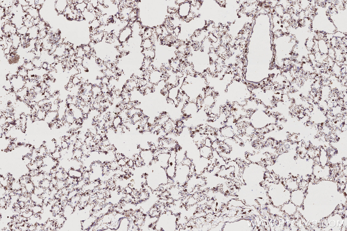 Immunohistochemical analysis of paraffin-embedded rat lung tissue slide using KHC2776 (SLC25A46 IHC Kit).