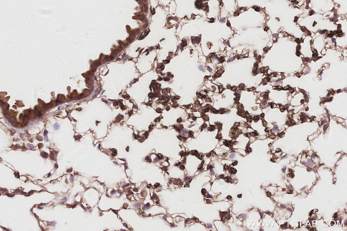 Immunohistochemical analysis of paraffin-embedded mouse lung tissue slide using KHC2907 (SLC38A1 IHC Kit).