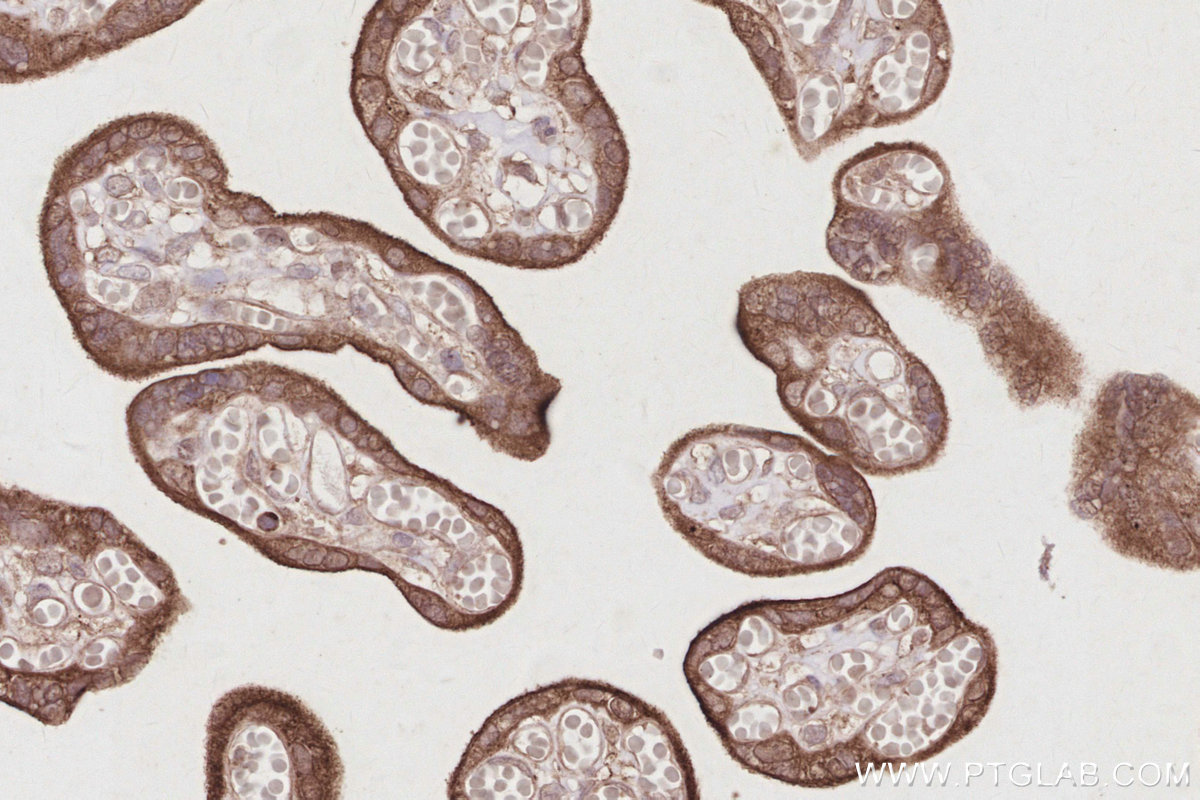 Immunohistochemical analysis of paraffin-embedded human placenta tissue slide using KHC2907 (SLC38A1 IHC Kit).