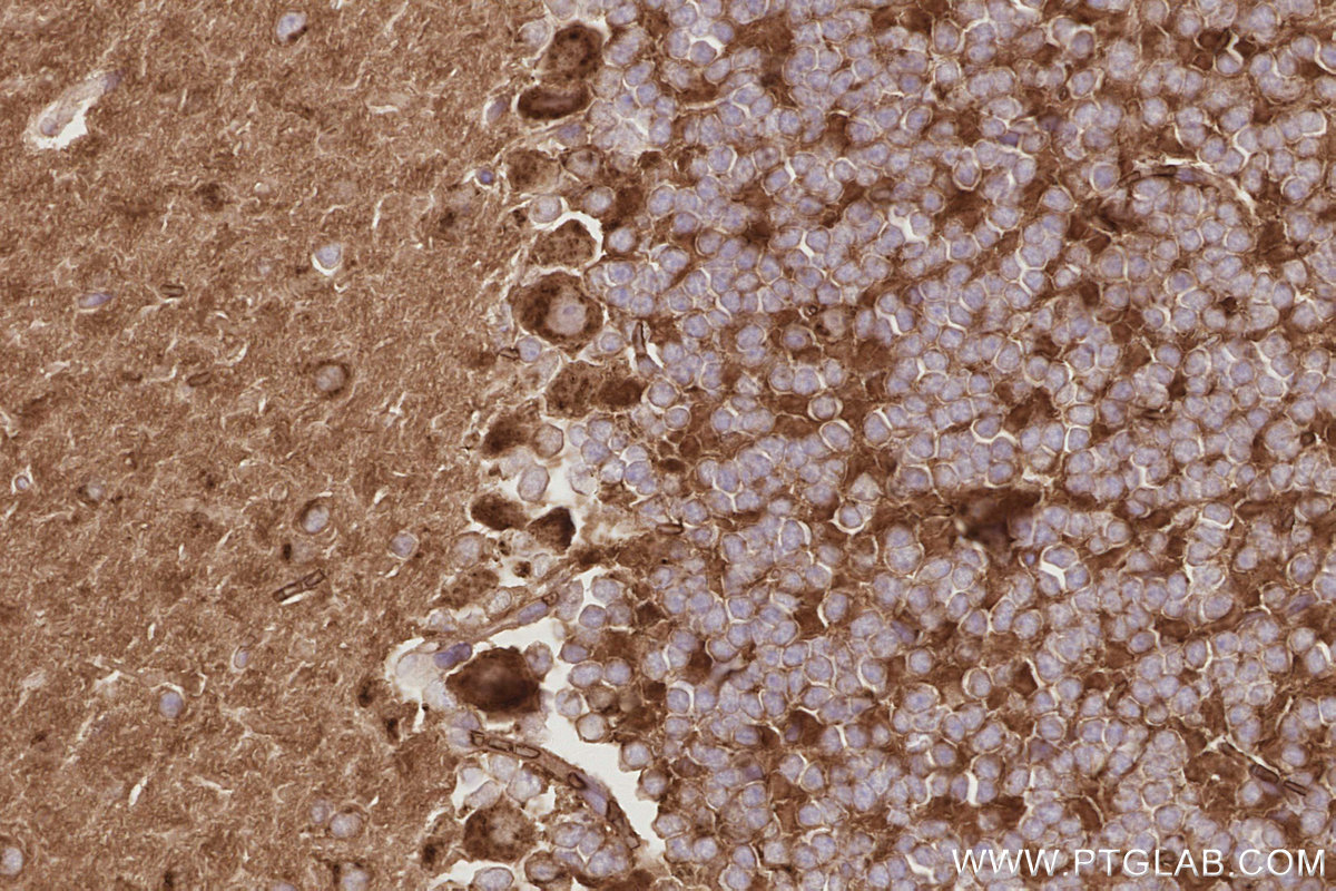 Immunohistochemical analysis of paraffin-embedded mouse cerebellum tissue slide using KHC2907 (SLC38A1 IHC Kit).