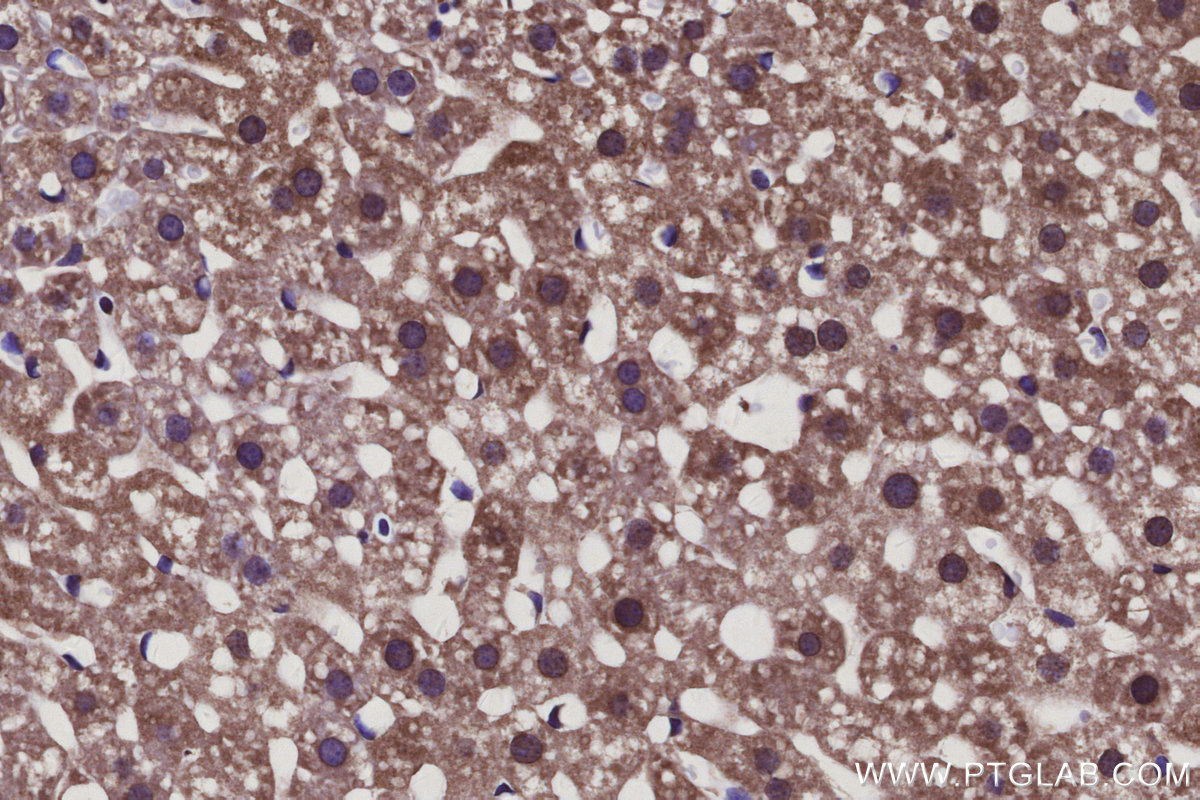 Immunohistochemical analysis of paraffin-embedded mouse liver tissue slide using KHC3114 (SLC39A3 IHC Kit).