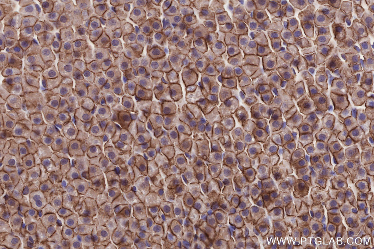 Immunohistochemical analysis of paraffin-embedded rat adrenal gland tissue slide using KHC2671 (SLC43A2 IHC Kit).