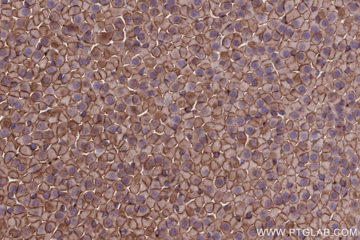 Immunohistochemical analysis of paraffin-embedded mouse adrenal gland tissue slide using KHC2671 (SLC43A2 IHC Kit).