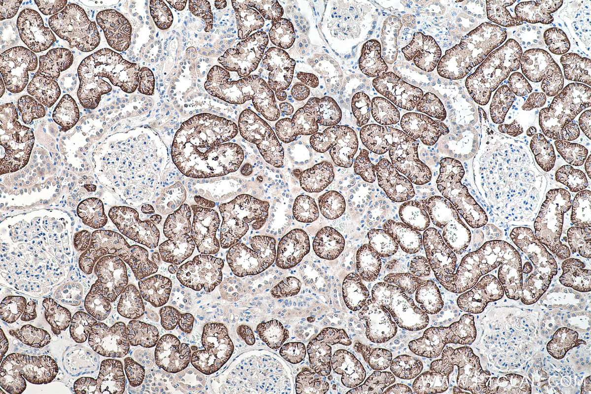 Immunohistochemical analysis of paraffin-embedded human kidney tissue slide using KHC0196 (SLC4A4 IHC Kit).