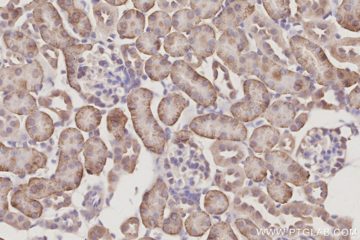 Immunohistochemical analysis of paraffin-embedded mouse kidney tissue slide using KHC3094 (SLC4A7/NBCn1 IHC Kit).