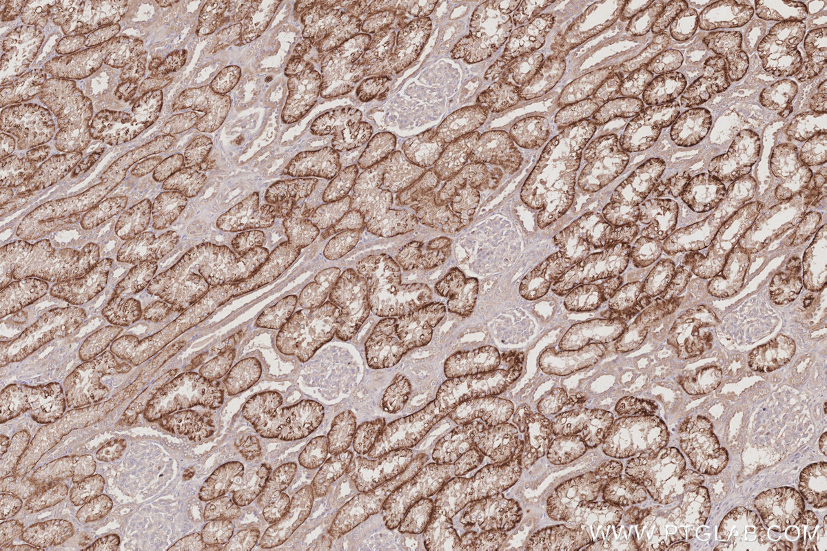 Immunohistochemical analysis of paraffin-embedded human kidney tissue slide using KHC3094 (SLC4A7/NBCn1 IHC Kit).