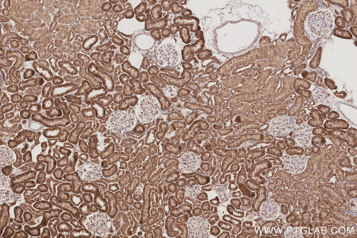 Immunohistochemical analysis of paraffin-embedded rat kidney tissue slide using KHC3094 (SLC4A7/NBCn1 IHC Kit).
