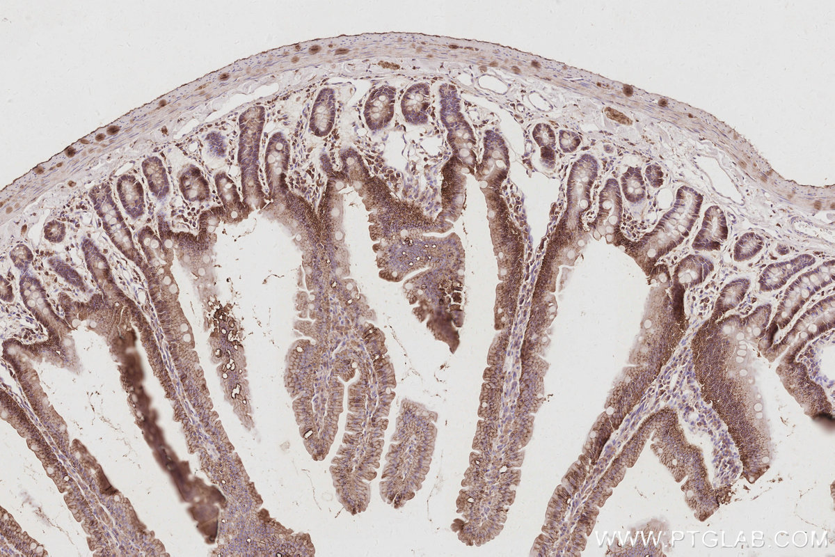 Immunohistochemical analysis of paraffin-embedded rat small intestine tissue slide using KHC3094 (SLC4A7/NBCn1 IHC Kit).