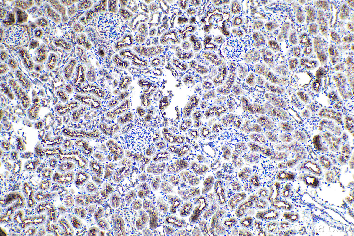 Immunohistochemical analysis of paraffin-embedded rat kidney tissue slide using KHC0891 (SLC9A3R1 IHC Kit).