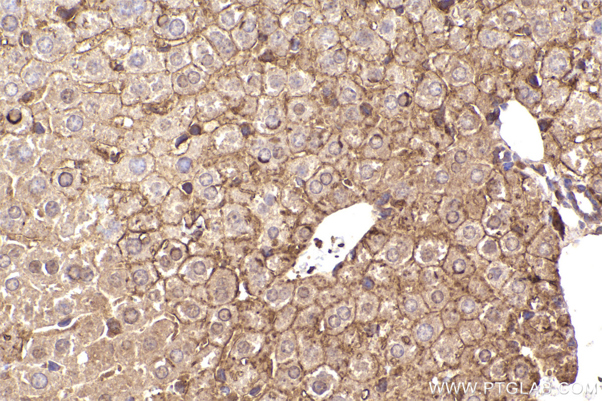 Immunohistochemical analysis of paraffin-embedded mouse liver tissue slide using KHC2277 (SLCO1A2 IHC Kit).