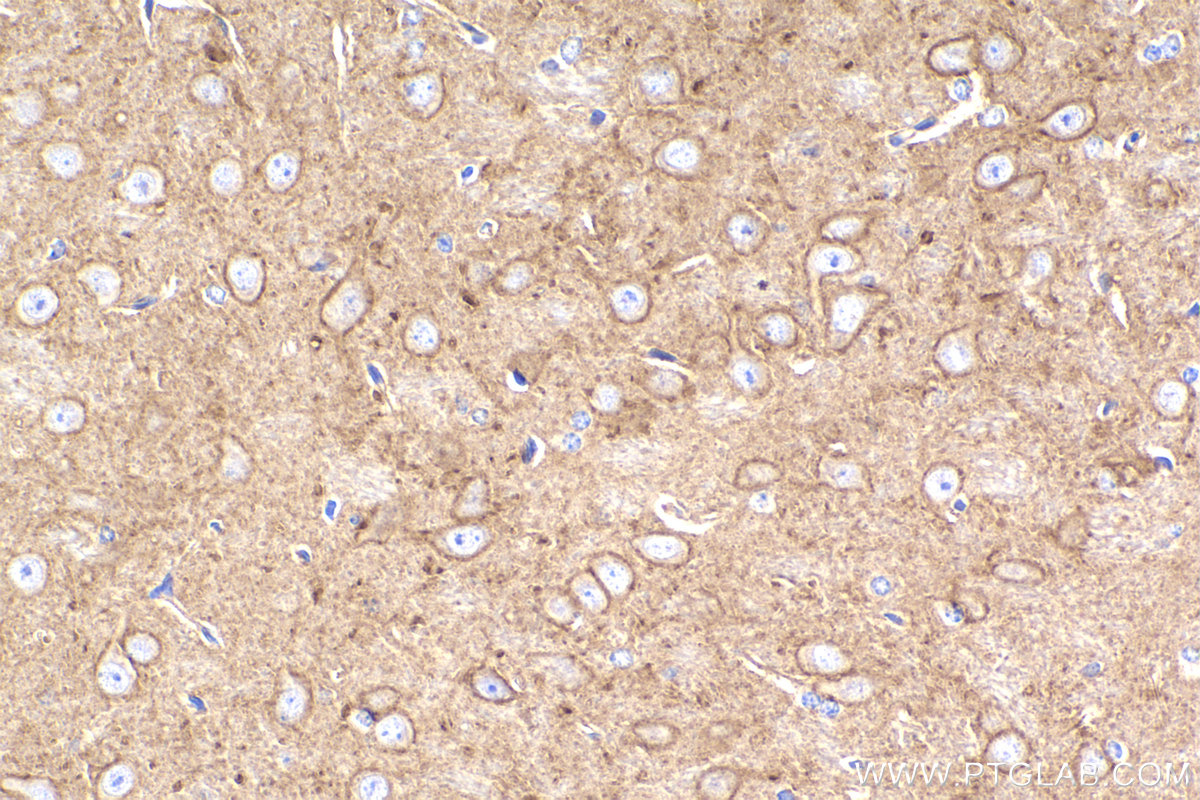 Immunohistochemical analysis of paraffin-embedded mouse brain tissue slide using KHC2277 (SLCO1A2 IHC Kit).