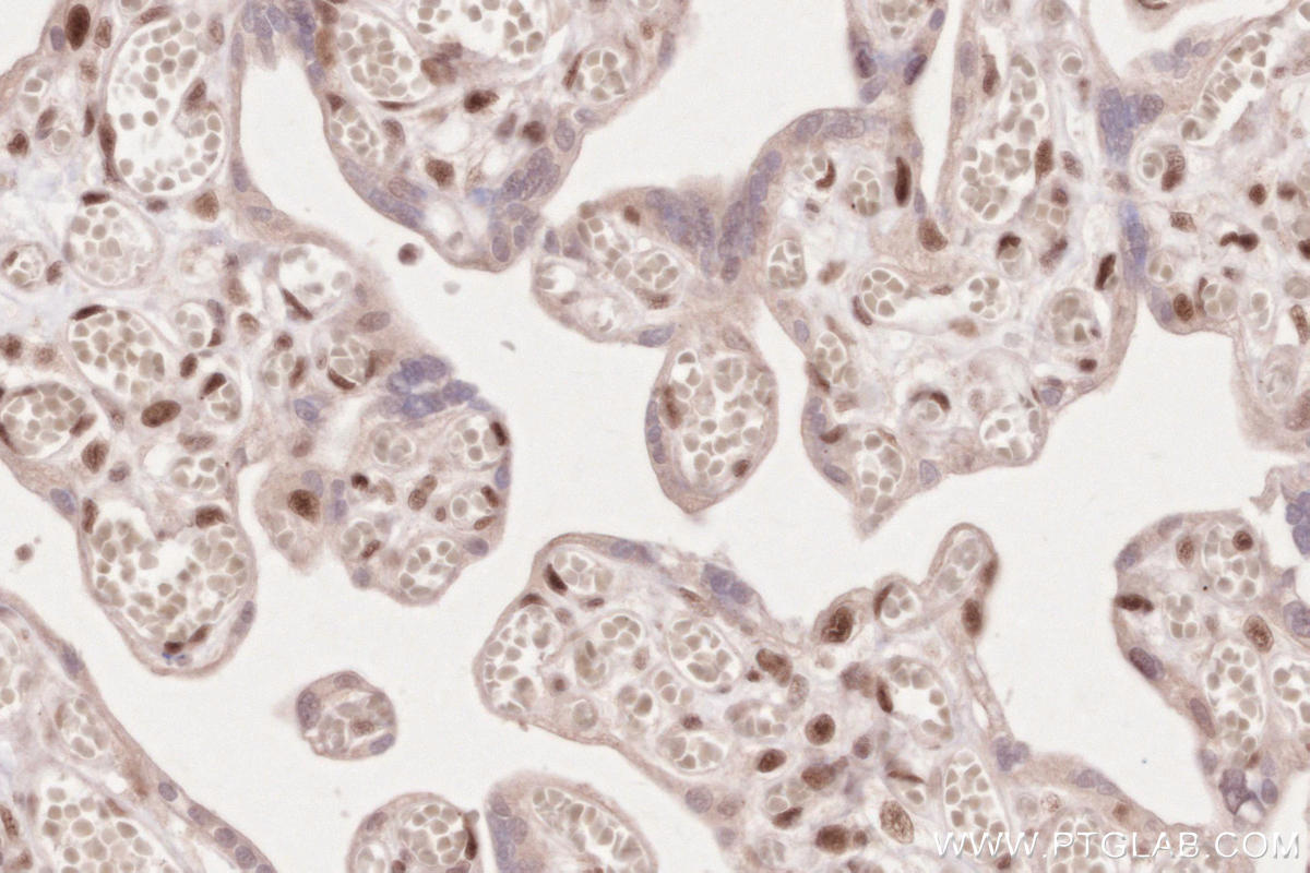 Immunohistochemical analysis of paraffin-embedded human placenta tissue slide using KHC2629 (SLFN11 IHC Kit).
