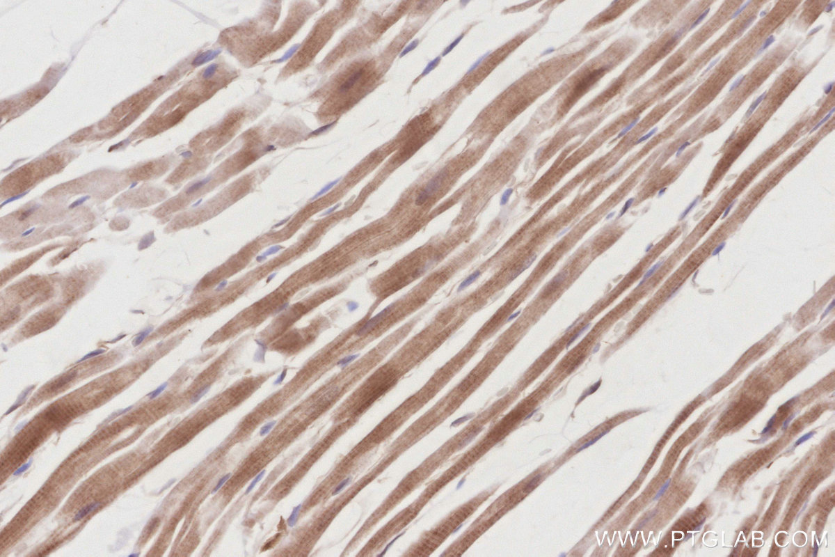 Immunohistochemical analysis of paraffin-embedded rat heart tissue slide using KHC2905 (SLK IHC Kit).