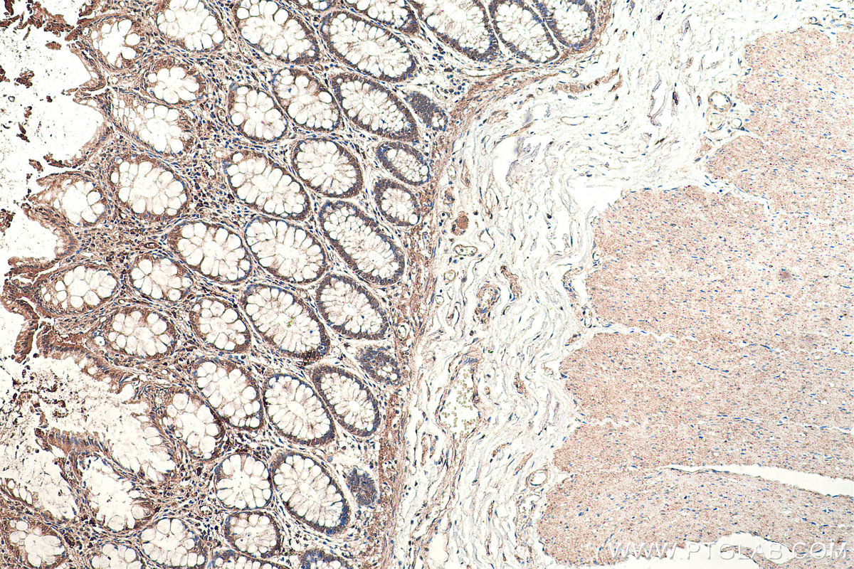 Immunohistochemical analysis of paraffin-embedded human colon tissue slide using KHC0389 (SMAD1 IHC Kit).