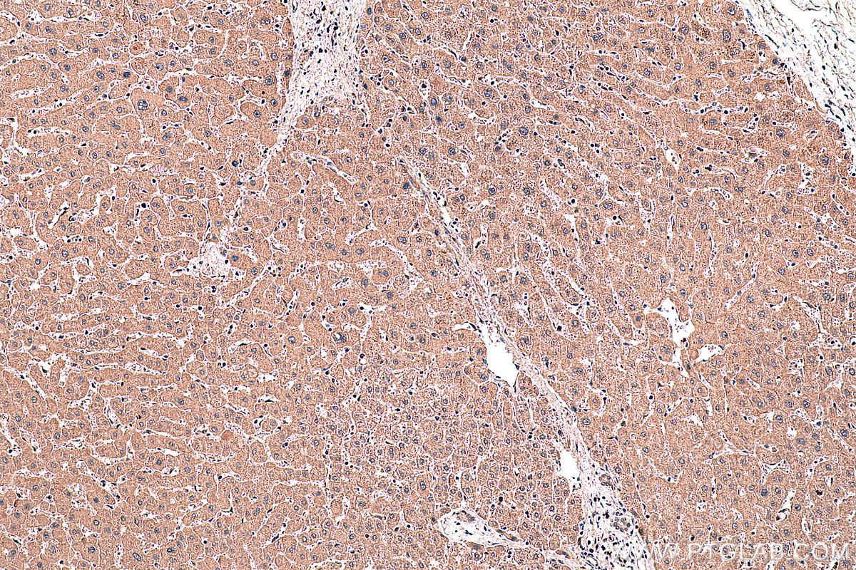 Immunohistochemical analysis of paraffin-embedded human liver tissue slide using KHC0389 (SMAD1 IHC Kit).