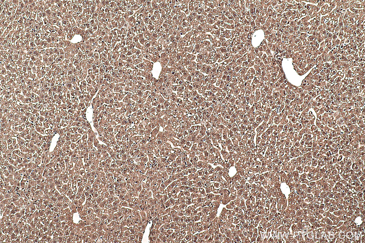 Immunohistochemical analysis of paraffin-embedded mouse liver tissue slide using KHC0389 (SMAD1 IHC Kit).