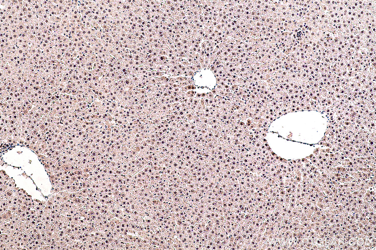 Immunohistochemical analysis of paraffin-embedded rat liver tissue slide using KHC0389 (SMAD1 IHC Kit).