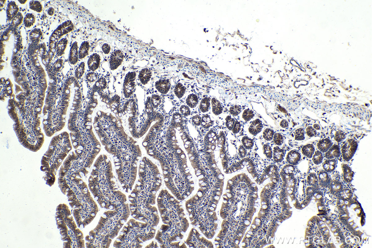 Immunohistochemical analysis of paraffin-embedded rat small intestine tissue slide using KHC1713 (SMAD4 IHC Kit).