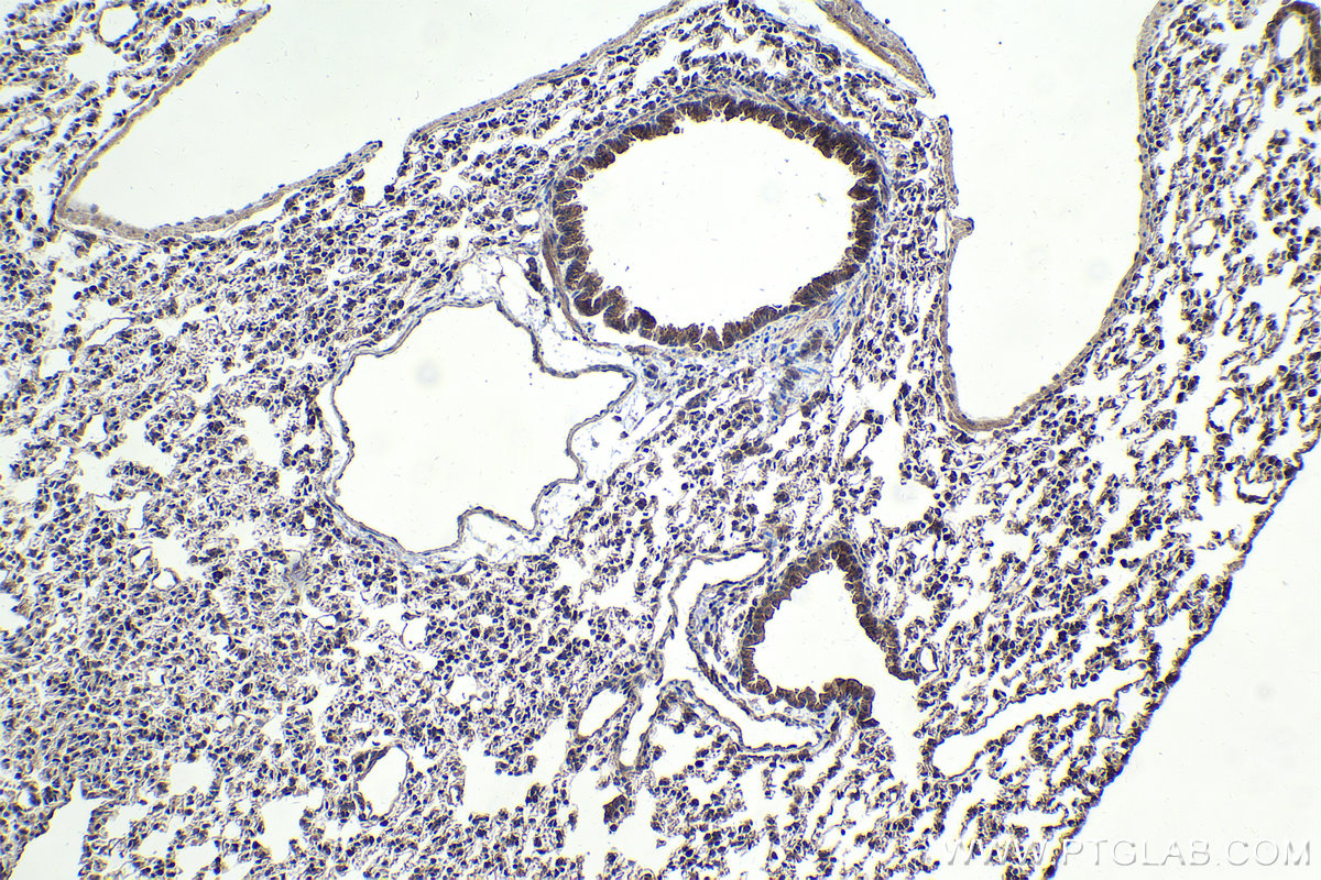 Immunohistochemical analysis of paraffin-embedded mouse lung tissue slide using KHC1713 (SMAD4 IHC Kit).