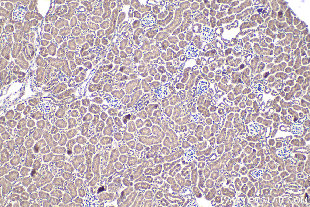 Immunohistochemical analysis of paraffin-embedded mouse kidney tissue slide using KHC1895 (SMAD5 IHC Kit).