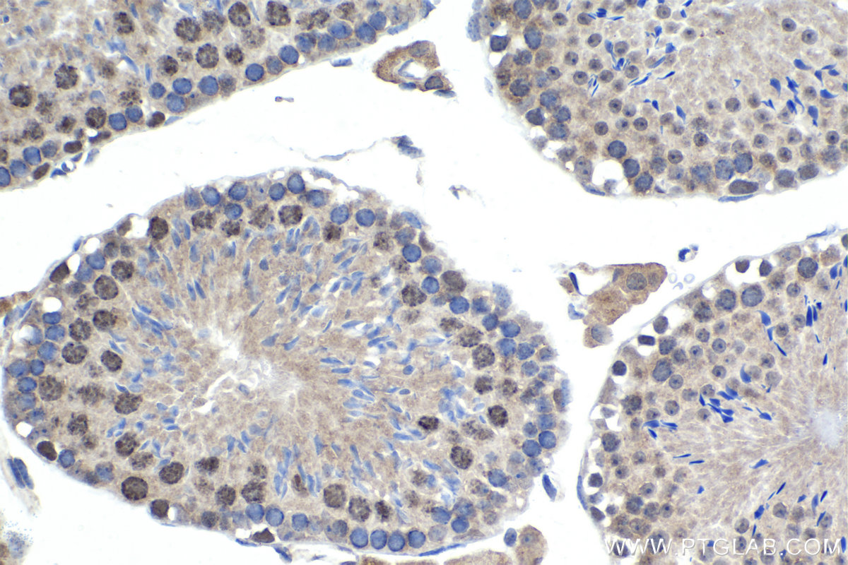 Immunohistochemical analysis of paraffin-embedded mouse testis tissue slide using KHC1463 (SMARCA5 IHC Kit).