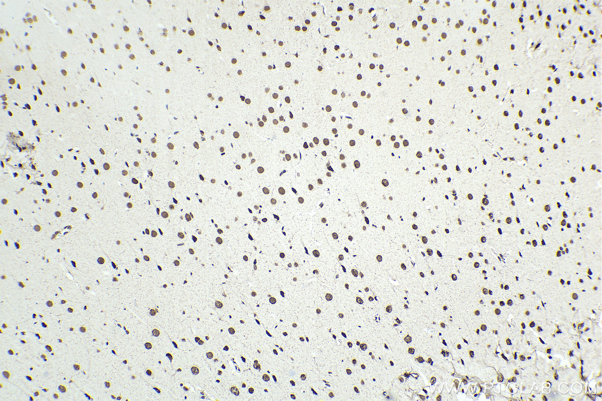 Immunohistochemical analysis of paraffin-embedded rat brain tissue slide using KHC1398 (SMARCC2 IHC Kit).