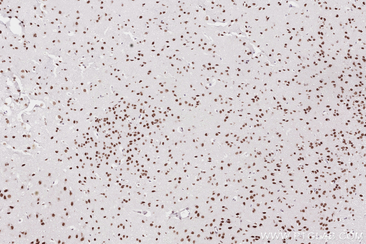 Immunohistochemical analysis of paraffin-embedded mouse brain tissue slide using KHC2794 (SMARCD1 IHC Kit).