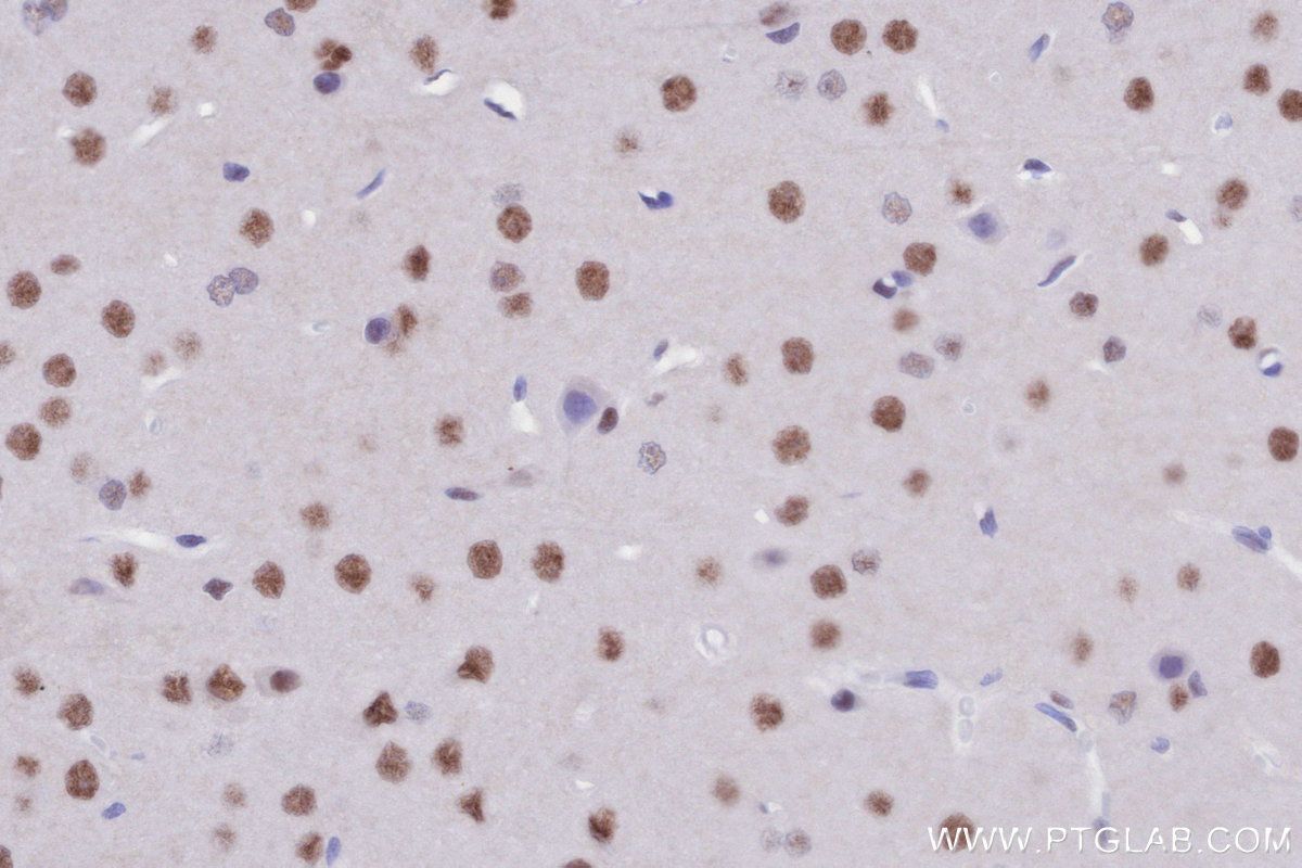 Immunohistochemical analysis of paraffin-embedded rat brain tissue slide using KHC2794 (SMARCD1 IHC Kit).