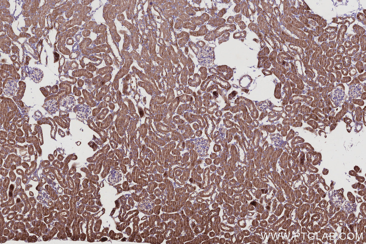 Immunohistochemical analysis of paraffin-embedded mouse kidney tissue slide using KHC2942 (SMCR7L/MID51 IHC Kit).