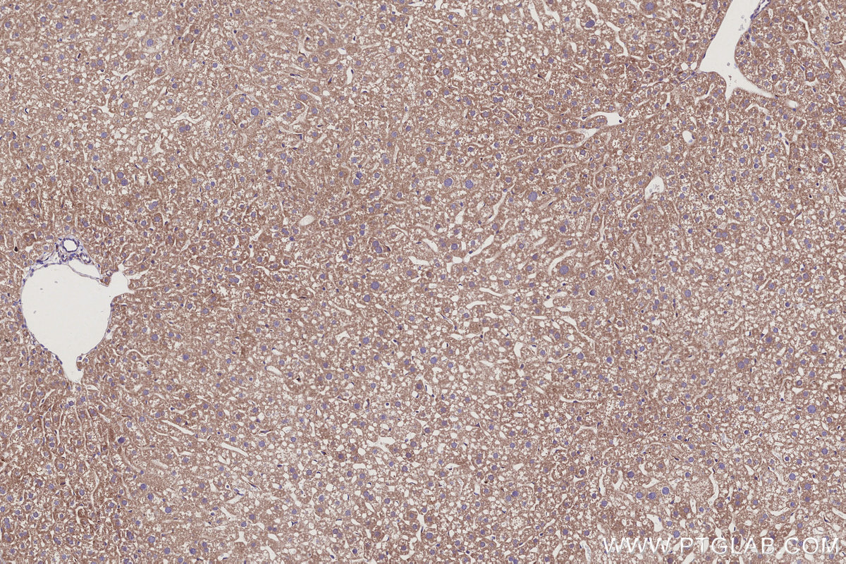 Immunohistochemical analysis of paraffin-embedded mouse liver tissue slide using KHC2942 (SMCR7L/MID51 IHC Kit).