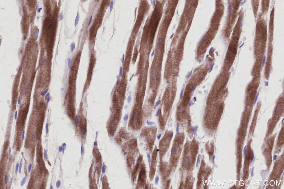 Immunohistochemical analysis of paraffin-embedded rat heart tissue slide using KHC2942 (SMCR7L/MID51 IHC Kit).