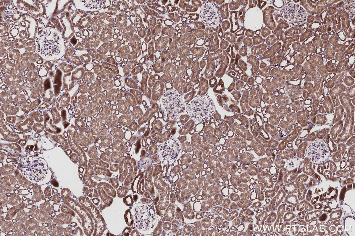 Immunohistochemical analysis of paraffin-embedded rat kidney tissue slide using KHC2942 (SMCR7L/MID51 IHC Kit).