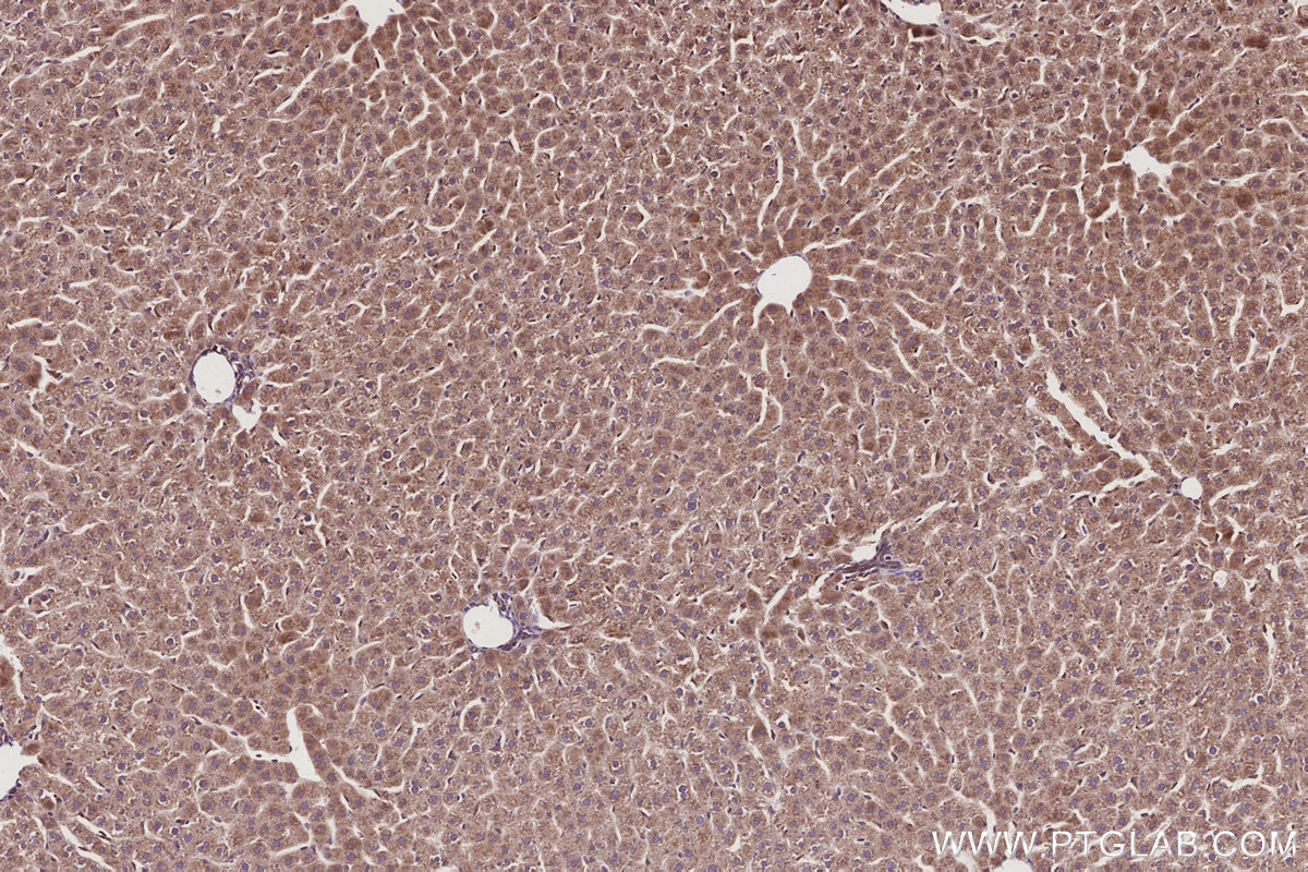 Immunohistochemical analysis of paraffin-embedded rat liver tissue slide using KHC2942 (SMCR7L/MID51 IHC Kit).
