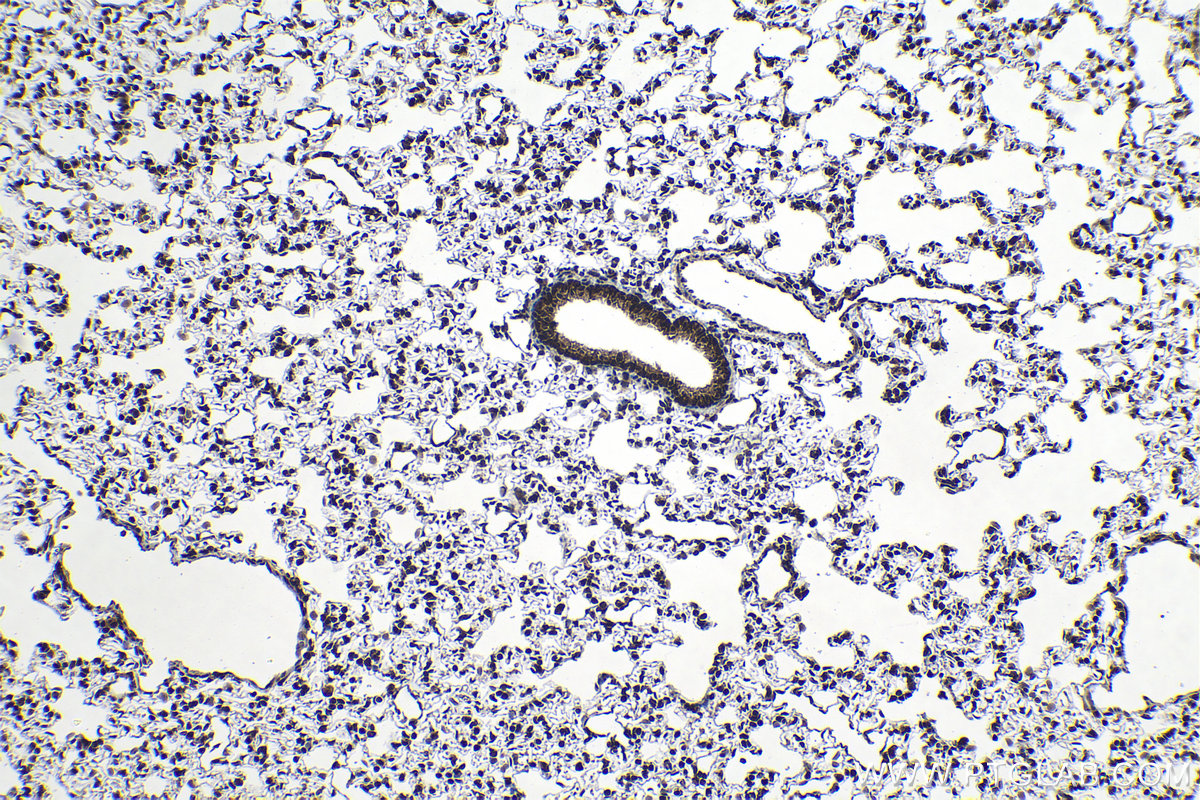 Immunohistochemical analysis of paraffin-embedded rat lung tissue slide using KHC1313 (SMU1 IHC Kit).