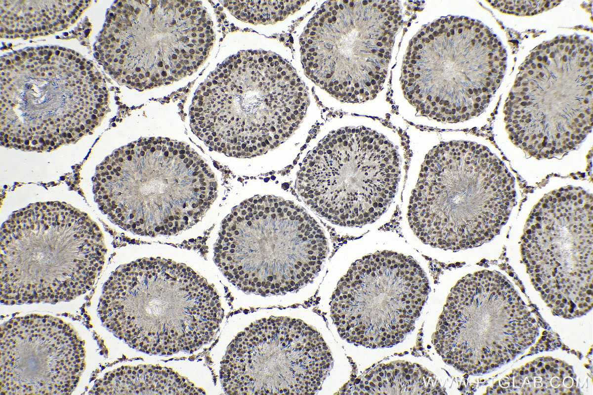 Immunohistochemical analysis of paraffin-embedded rat testis tissue slide using KHC1313 (SMU1 IHC Kit).