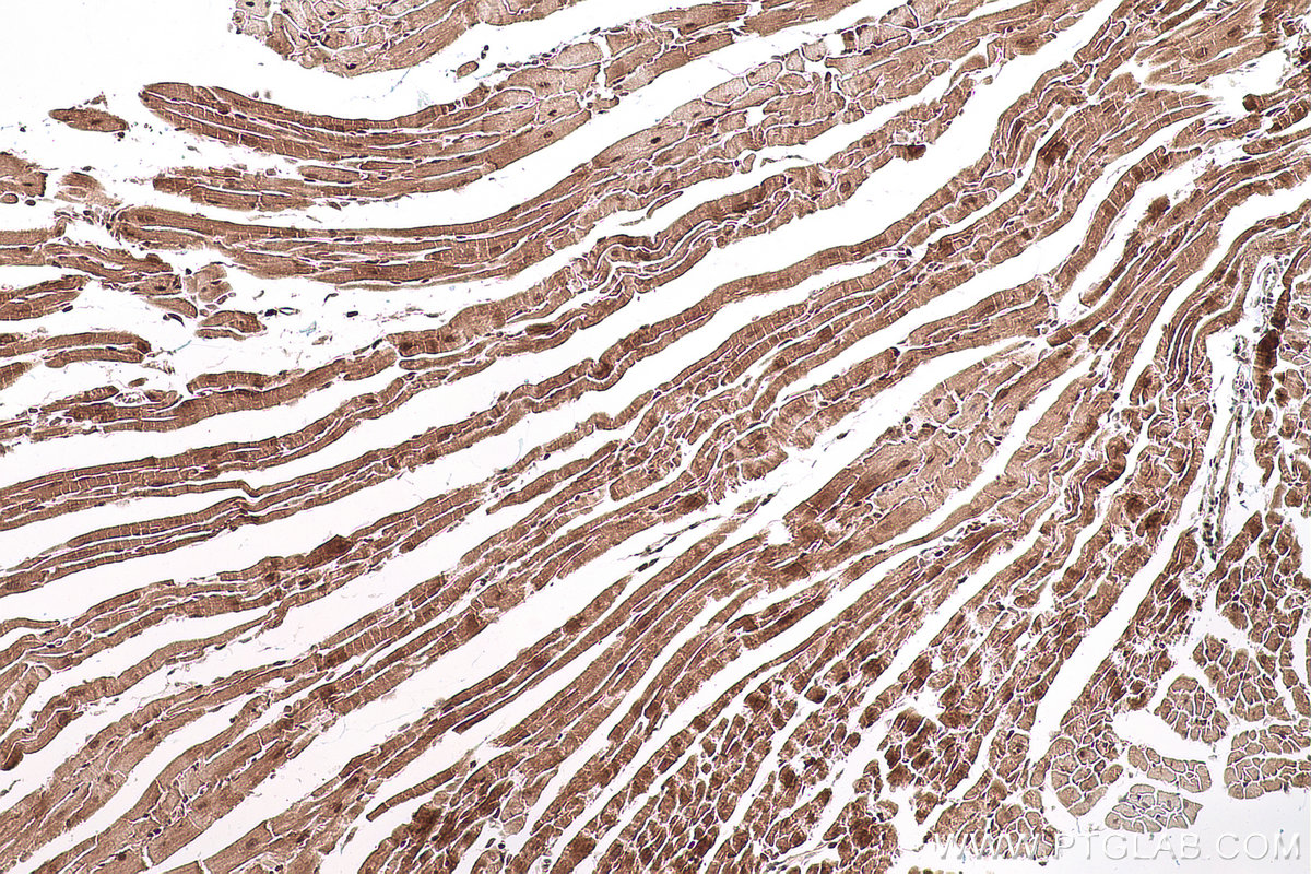 Immunohistochemical analysis of paraffin-embedded mouse heart tissue slide using KHC0769 (SMYD2 IHC Kit).