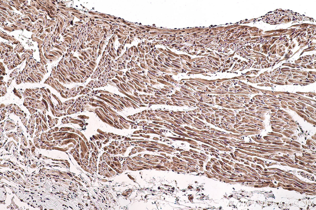 Immunohistochemical analysis of paraffin-embedded rat heart tissue slide using KHC0769 (SMYD2 IHC Kit).