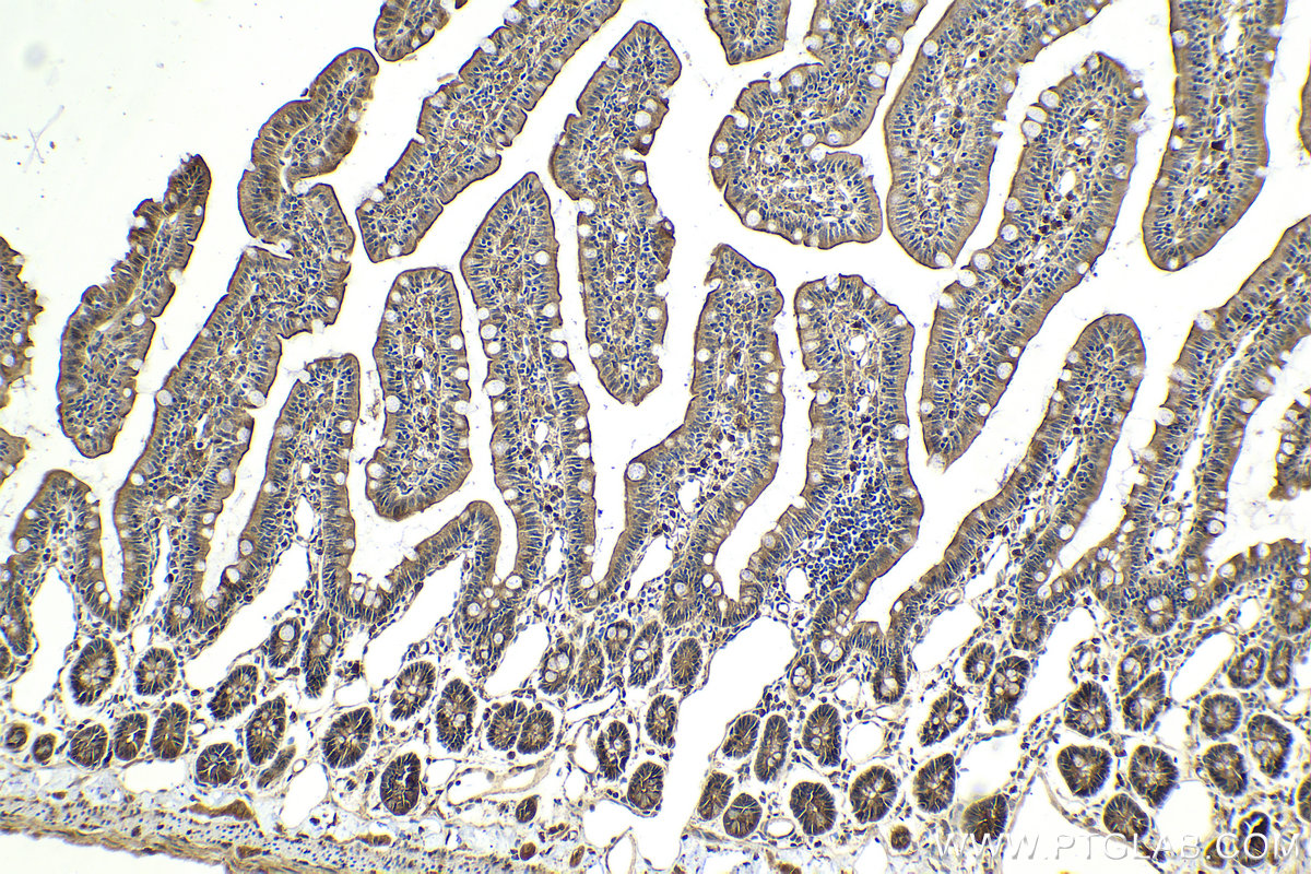Immunohistochemical analysis of paraffin-embedded rat small intestine tissue slide using KHC2040 (SNAP23 IHC Kit).