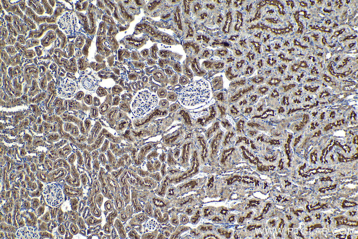 Immunohistochemical analysis of paraffin-embedded rat kidney tissue slide using KHC2040 (SNAP23 IHC Kit).