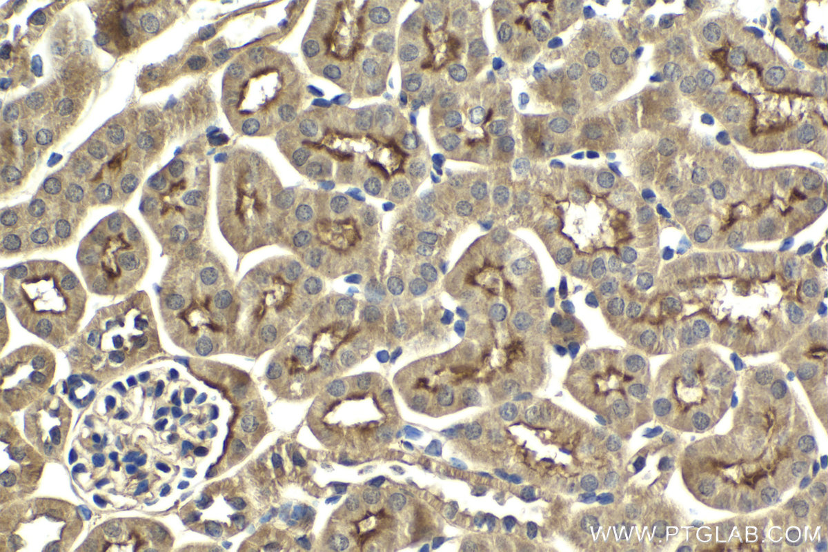 Immunohistochemical analysis of paraffin-embedded mouse kidney tissue slide using KHC2040 (SNAP23 IHC Kit).