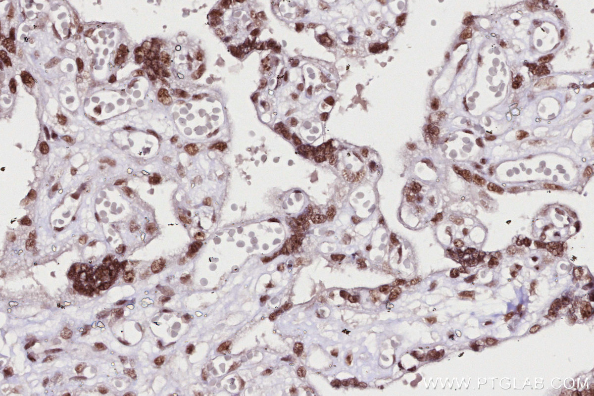 Immunohistochemical analysis of paraffin-embedded human placenta tissue slide using KHC2703 (SNIP1 IHC Kit).