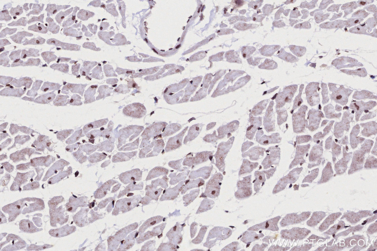 Immunohistochemical analysis of paraffin-embedded rat heart tissue slide using KHC2703 (SNIP1 IHC Kit).