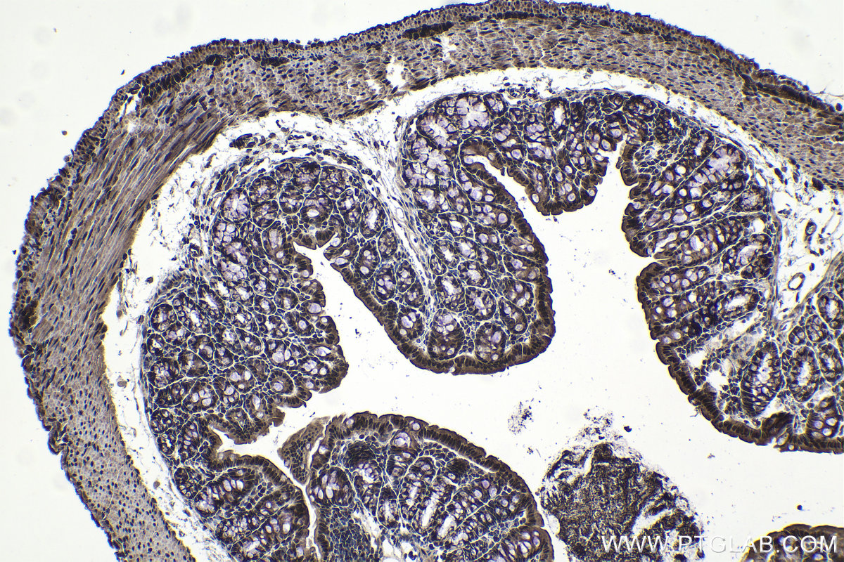 Immunohistochemical analysis of paraffin-embedded mouse colon tissue slide using KHC0977 (SNRPB IHC Kit).