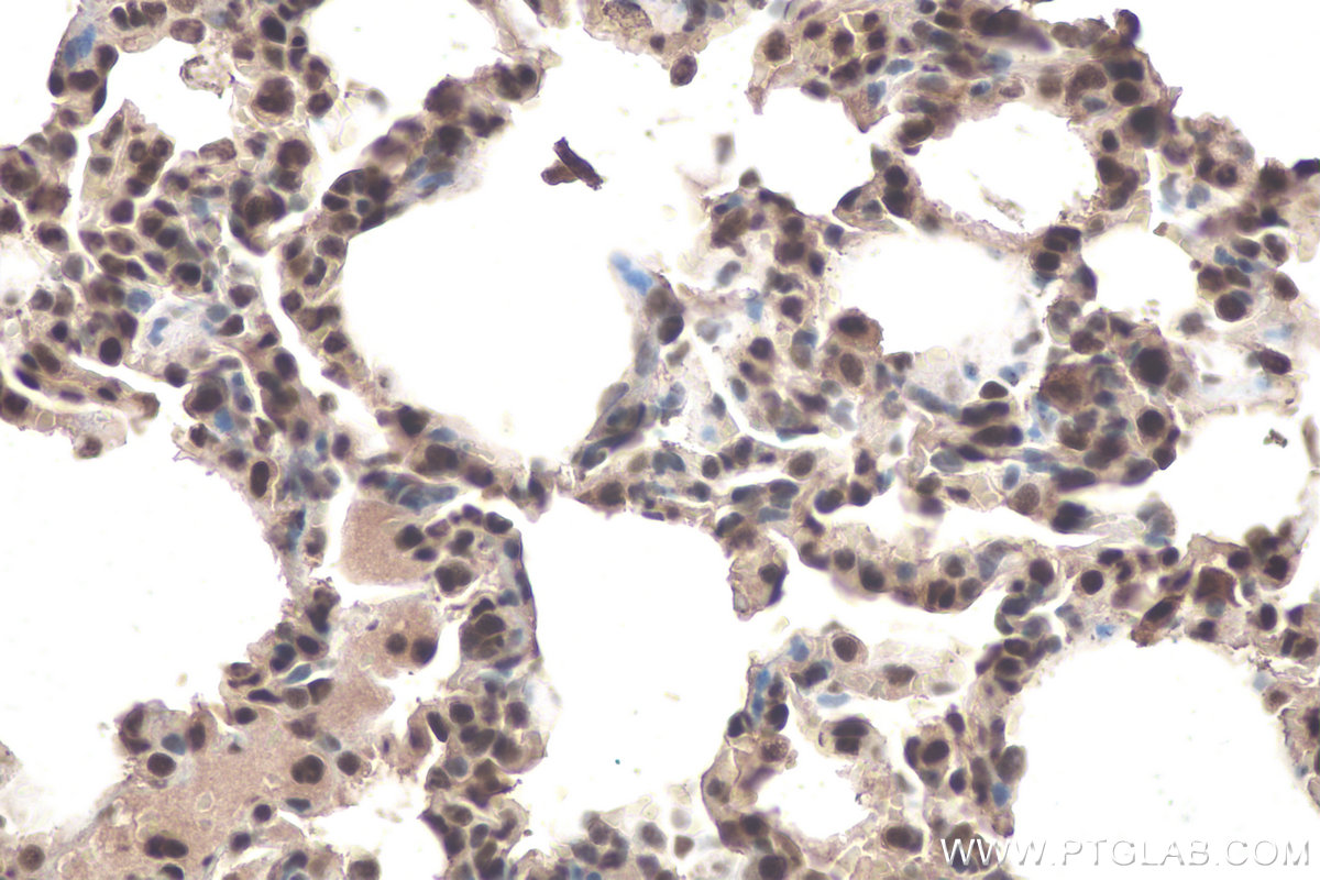 Immunohistochemical analysis of paraffin-embedded rat lung tissue slide using KHC0882 (SNRPG IHC Kit).