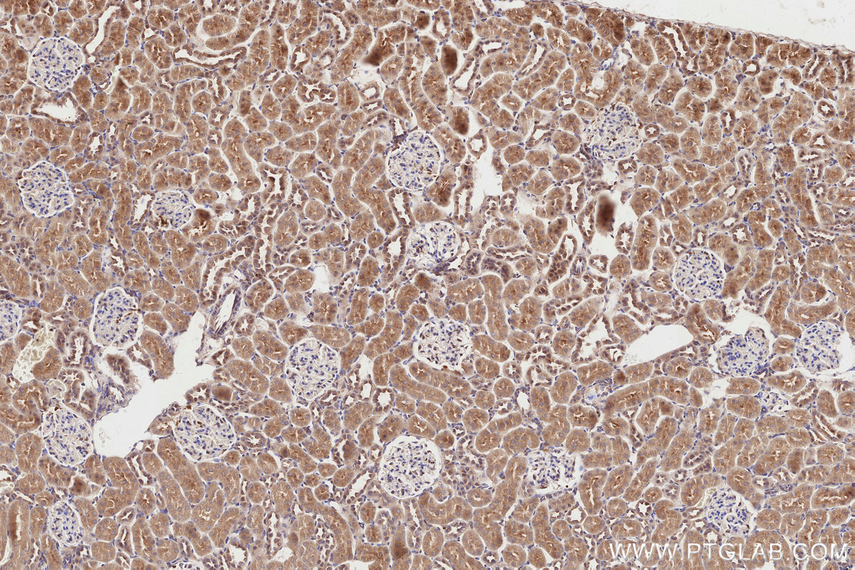 Immunohistochemical analysis of paraffin-embedded rat kidney tissue slide using KHC2825 (SNX18 IHC Kit).