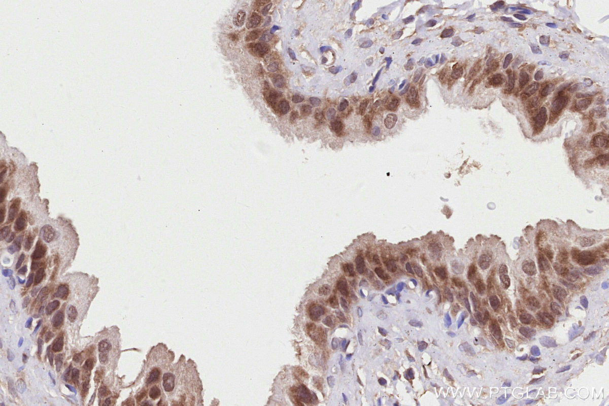 Immunohistochemical analysis of paraffin-embedded rat bladder tissue slide using KHC2825 (SNX18 IHC Kit).