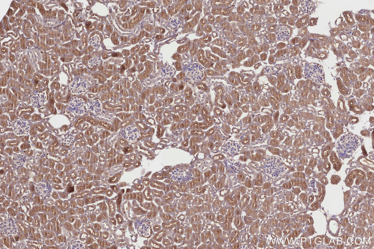 Immunohistochemical analysis of paraffin-embedded mouse kidney tissue slide using KHC2825 (SNX18 IHC Kit).