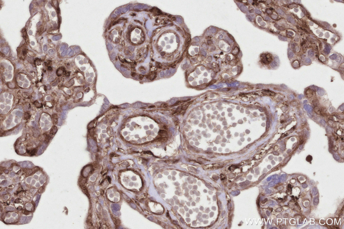 Immunohistochemical analysis of paraffin-embedded human placenta tissue slide using KHC2825 (SNX18 IHC Kit).